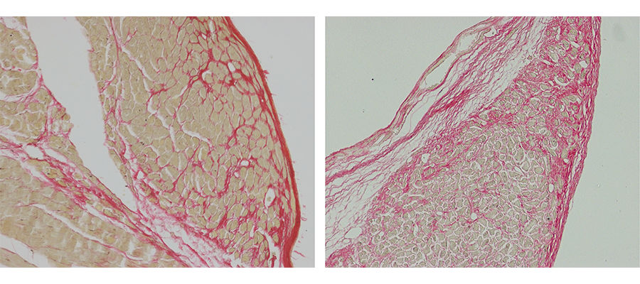 Heart sections from mice that are 8 weeks post-heart attack (myocardial infarction)