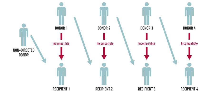 Living kidney donor donation diagram