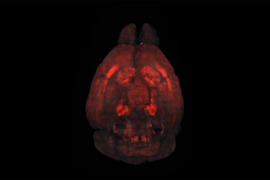 Kappa Opioid Receptor Distribution 3D Video Rendering