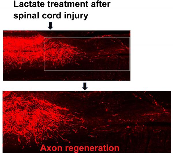 Lactate treatment after spinal cord injury