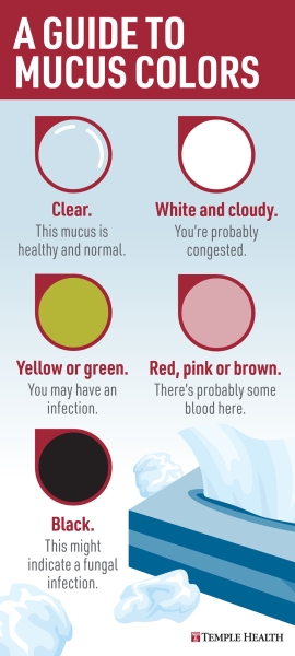 A guide to mucus colors